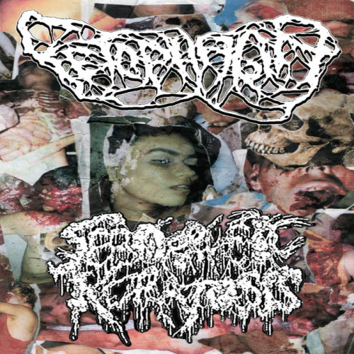 Seborrheic Keratosis : Fetophagia Seborrheic Keratosis